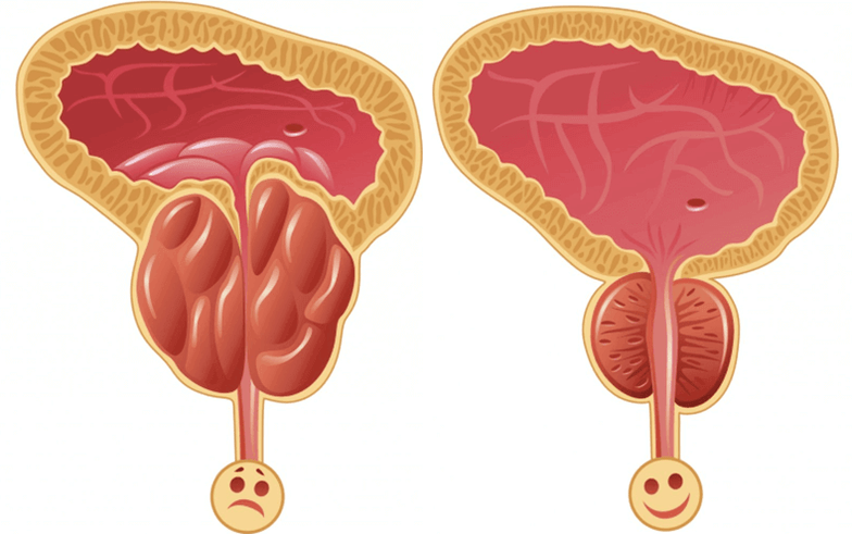 себептери көйгөйлөр потенции эркектерде